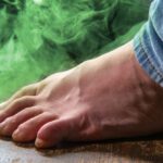 foot odor