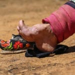 Chinese Foot binding