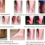 foot posture index